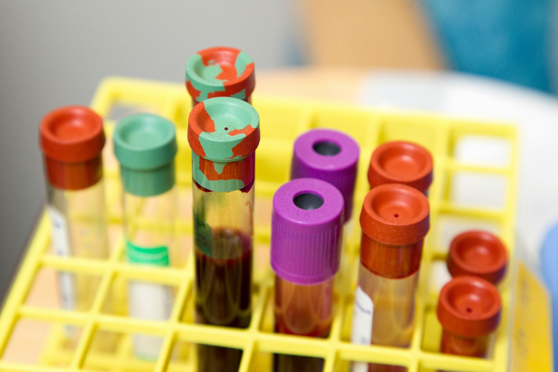 Blood sample